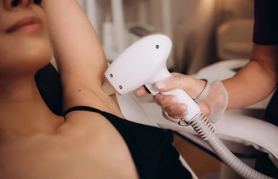 Épilation Laser